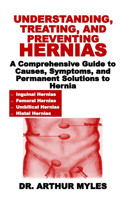 Kniha Understanding, Treating, and Preventing Hernias Dr. Arthur Myles