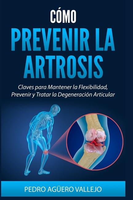 Kniha Cómo Prevenir la Artrosis Pedro Agüero Vallejo