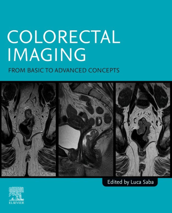 E-book Colorectal Imaging Luca Saba