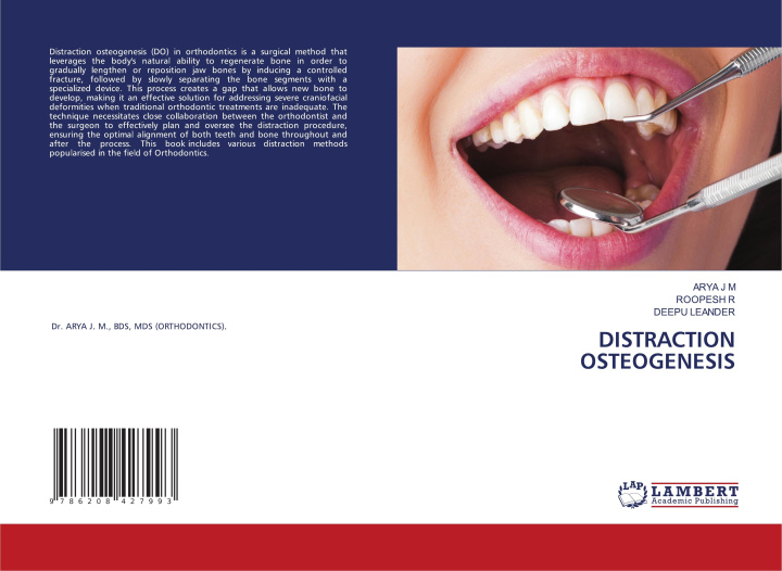 Kniha DISTRACTION OSTEOGENESIS Roopesh R