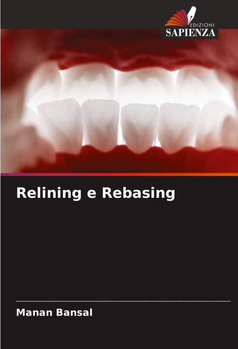 Knjiga Relining e Rebasing Manan Bansal