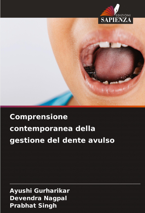 Boek Comprensione contemporanea della gestione del dente avulso Devendra Nagpal