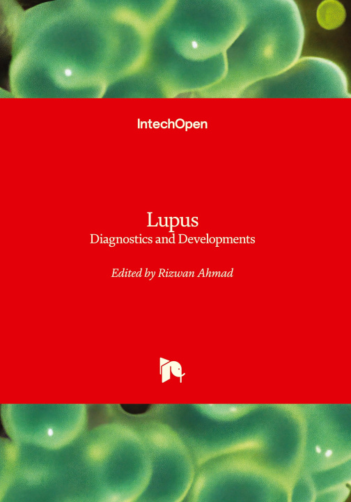 Kniha Lupus - Diagnostics and Developments Rizwan Ahmad