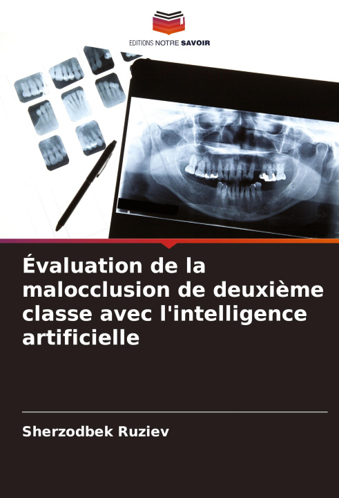 Kniha Évaluation de la malocclusion de deuxi?me classe avec l'intelligence artificielle Sherzodbek Ruziev