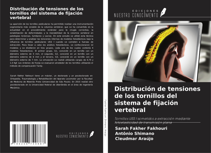 Kniha Distribución de tensiones de los tornillos del sistema de fijación vertebral Antônio Shimano