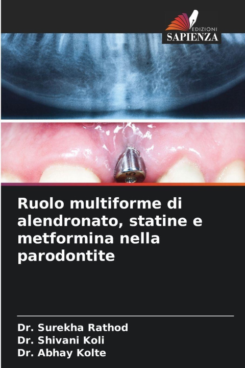 Kniha Ruolo multiforme di alendronato, statine e metformina nella parodontite Dr. Surekha Rathod
