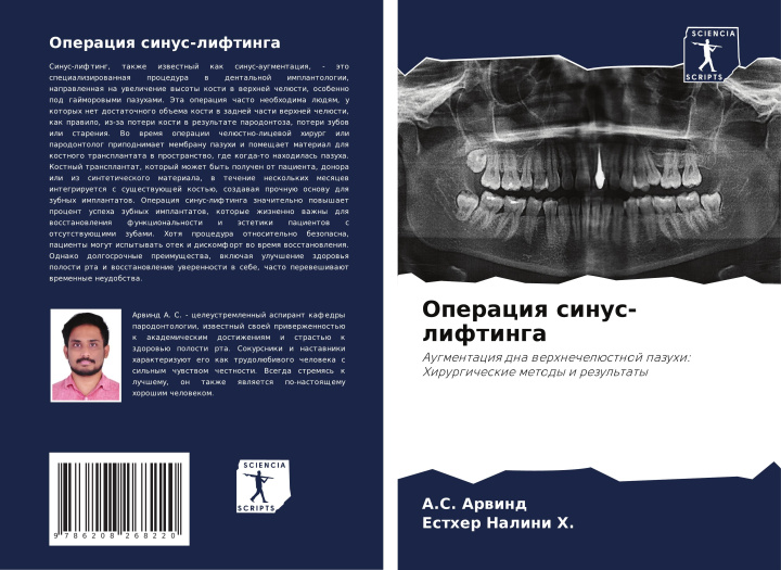 Knjiga Operaciq sinus-liftinga Esther Nalini H.