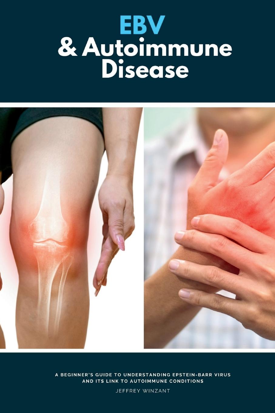 Βιβλίο EBV & Autoimmune Disease 