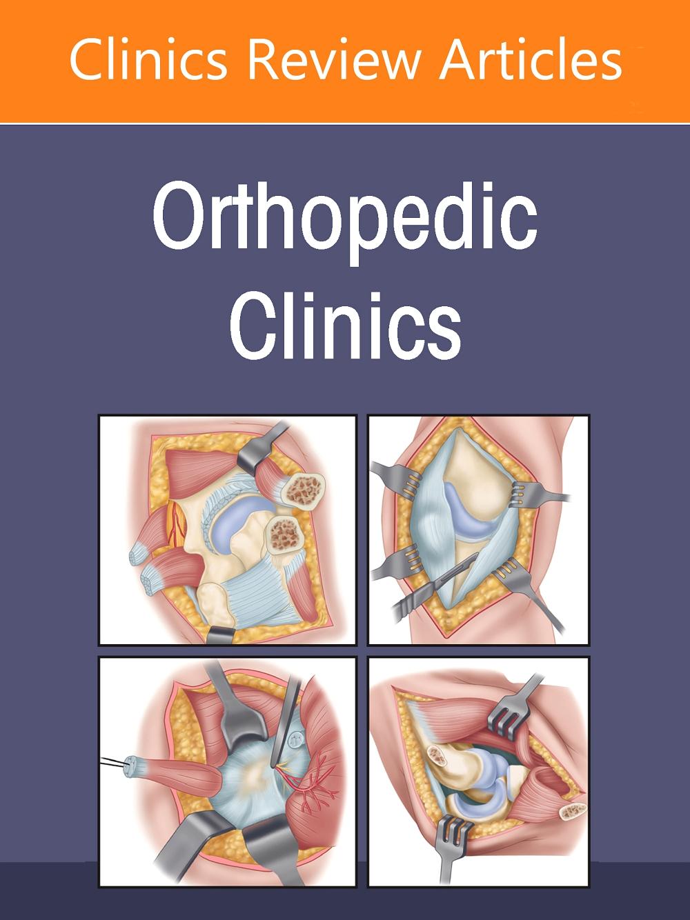 Libro Sports-Related Injuries, An Issue of Orthopedic Clinics Frederick M. Azar