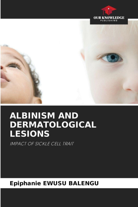 Knjiga ALBINISM AND DERMATOLOGICAL LESIONS Epiphanie EWUSU BALENGU