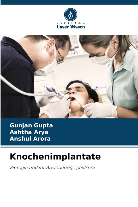 Kniha Knochenimplantate Gunjan Gupta