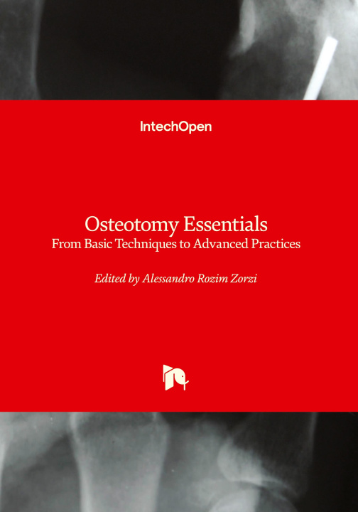Kniha Osteotomy Essentials - From Basic Techniques to Advanced Practices 