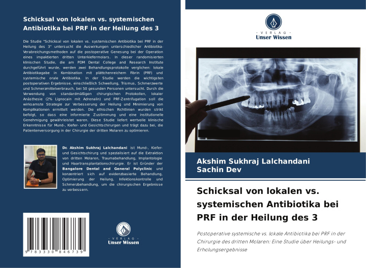 Libro Schicksal von lokalen vs. systemischen Antibiotika bei PRF in der Heilung des 3 Sachin Dev