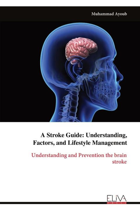 Kniha A Stroke Guide 