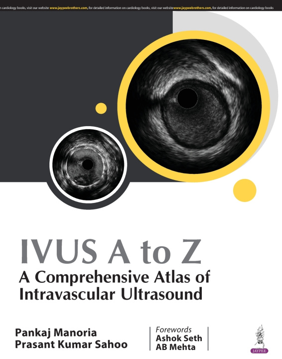 Knjiga IVUS A to Z Prasant Kumar Sahoo