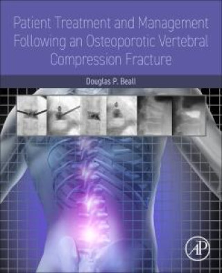 Livro Patient Treatment and Management Following an Osteoporotic Vertebral Compression Fracture Douglas P. Beall