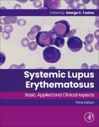 Książka Systemic Lupus Erythematosus George C. Tsokos