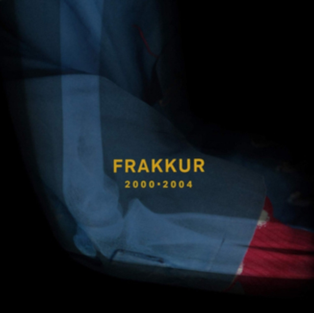 Audio 2000-2004 Frakkur