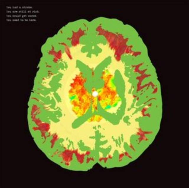 Audio Stroke Manor (RSD 2019) The Minus 5