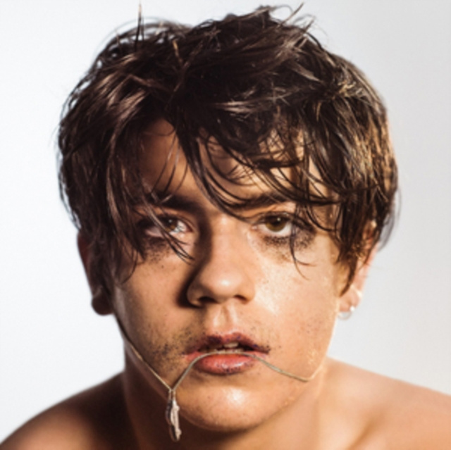 Audio What Do You Think About the Car? Declan McKenna