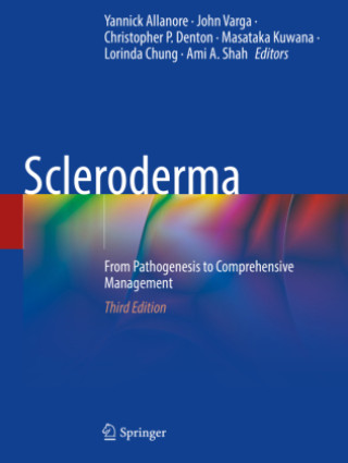 Kniha Scleroderma John Varga