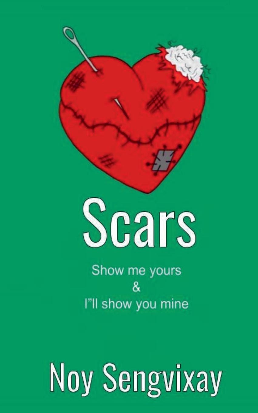 Kniha Scars Noy Sengvixay