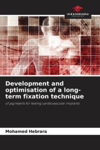 Kniha Development and optimisation of a long-term fixation technique Mohamed Hebrara
