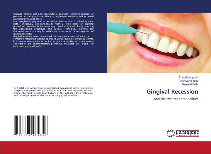 Knjiga Gingival Recession Aishwarya Ikhar