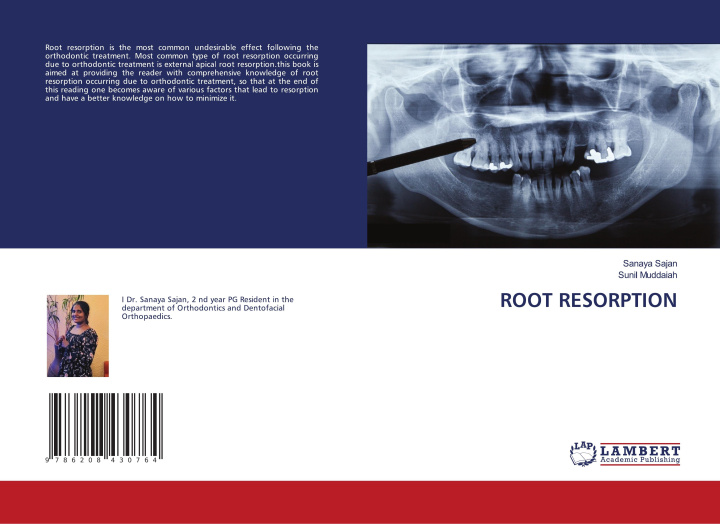 Knjiga ROOT RESORPTION Sunil Muddaiah