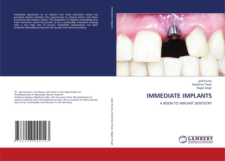 Knjiga IMMEDIATE IMPLANTS Karishma Tiwari