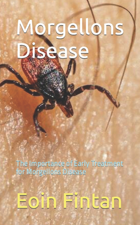 Kniha Morgellons Disease Eoin Fintan