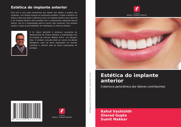 Carte Estética do implante anterior Sharad Gupta