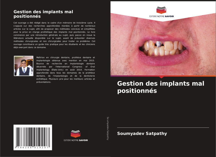 Kniha Gestion des implants mal positionnés Soumyadev Satpathy