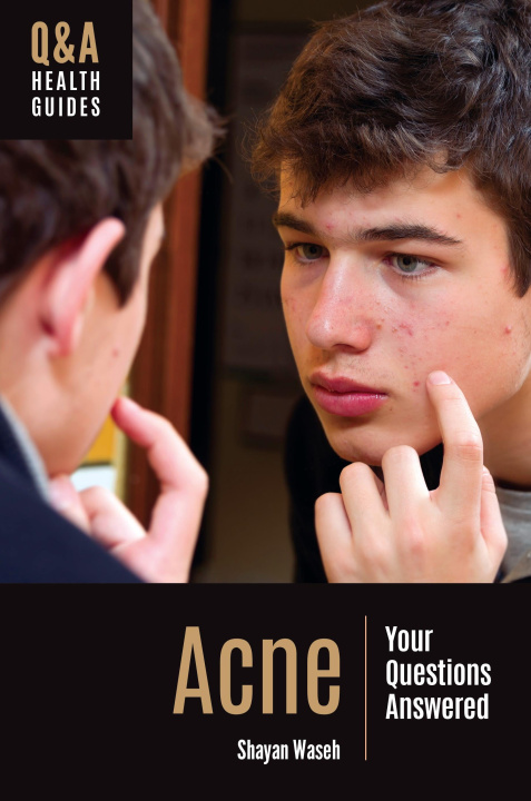 Kniha Acne Shayan Waseh