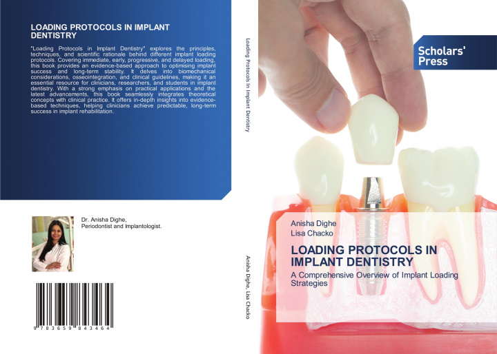 Kniha LOADING PROTOCOLS IN IMPLANT DENTISTRY Lisa Chacko