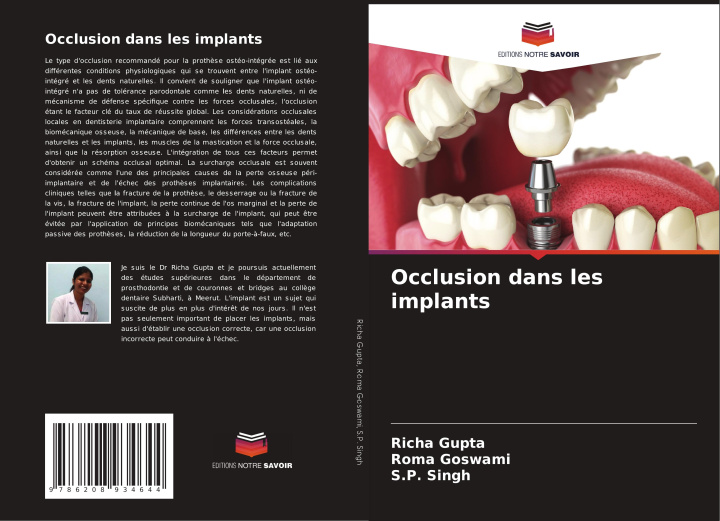 Kniha Occlusion dans les implants Roma Goswami