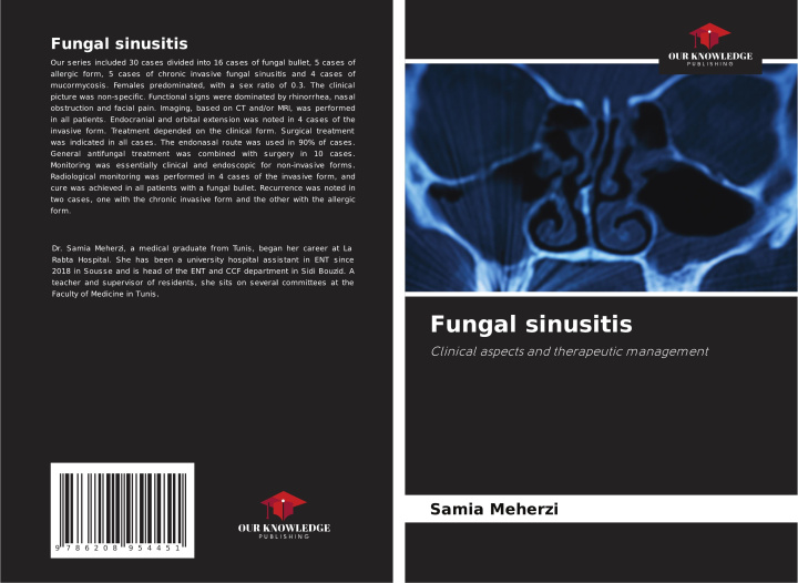Book Fungal sinusitis Samia Meherzi