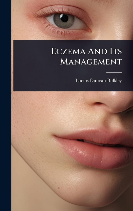 Knjiga Eczema And Its Management 