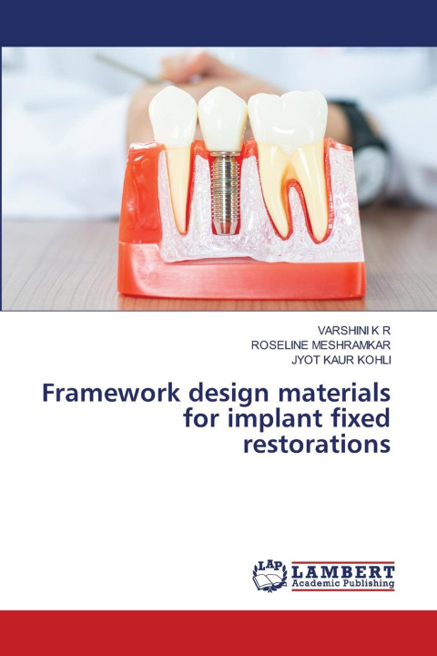 Knjiga Framework design materials for implant fixed restorations Roseline Meshramkar