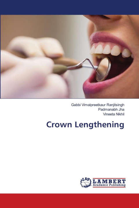 Kniha Crown Lengthening Padmanabh Jha