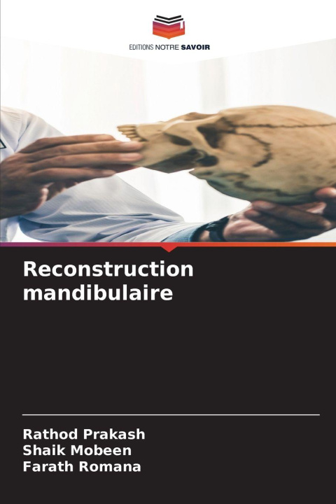 Knjiga Reconstruction mandibulaire Shaik Mobeen