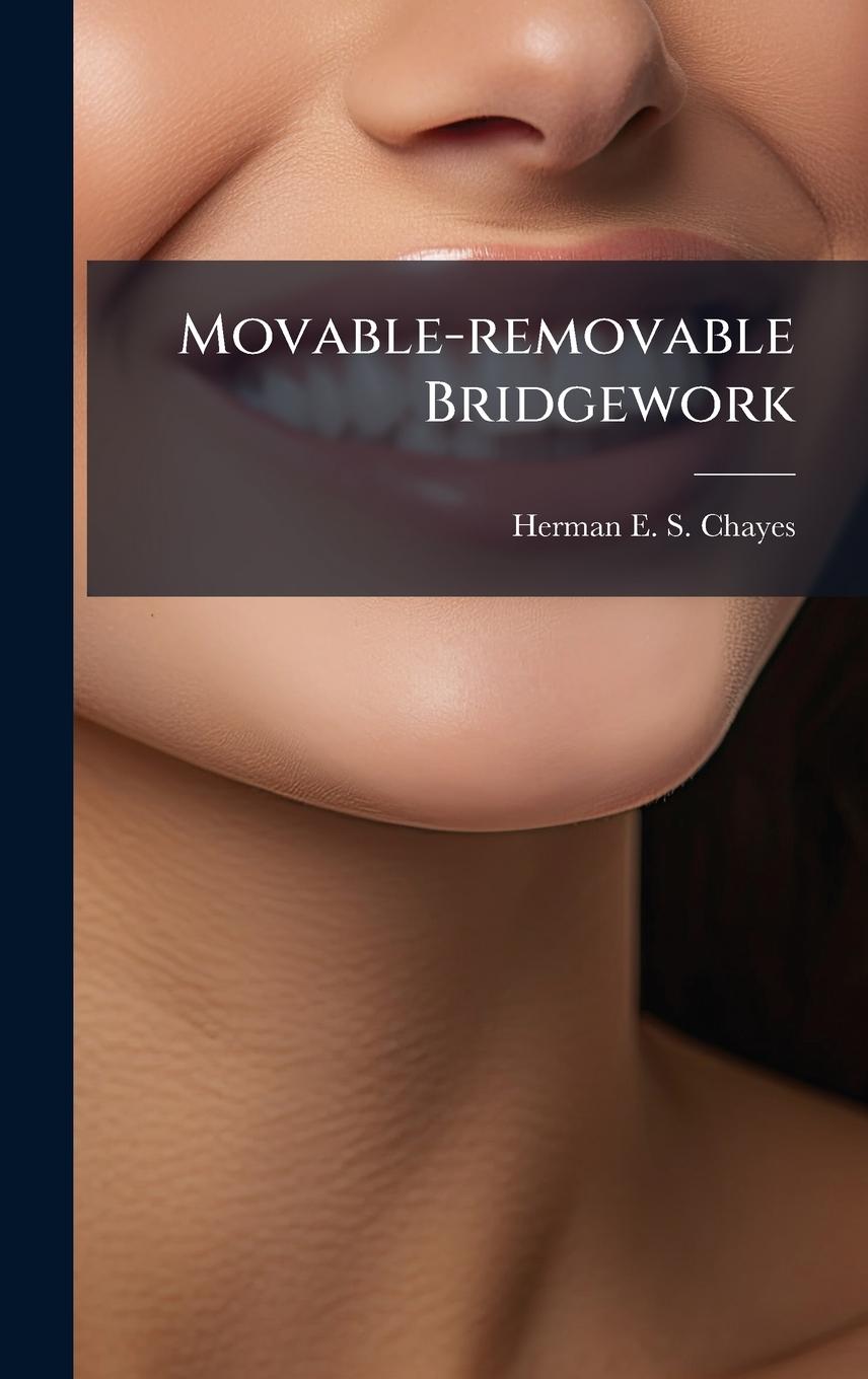 Kniha Movable-removable Bridgework 