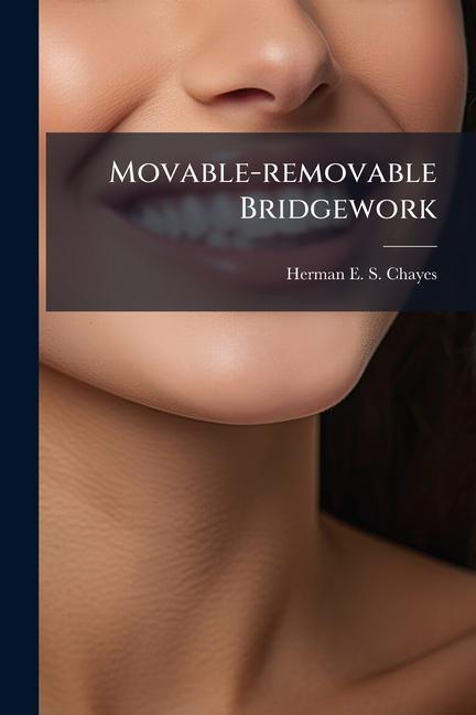 Kniha Movable-removable Bridgework 