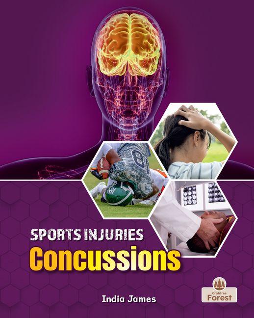 Knjiga Concussions 
