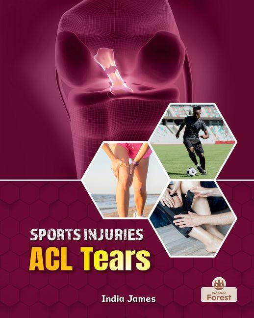 Kniha ACL Tears 