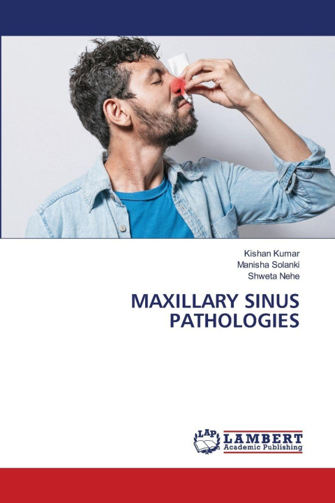 Knjiga MAXILLARY SINUS PATHOLOGIES Manisha Solanki
