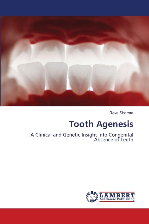 Knjiga Tooth Agenesis Reva Sharma