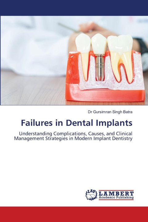 Kniha Failures in Dental Implants Dr Gursimran Singh Batra