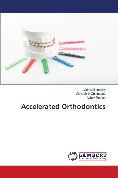 Kniha Accelerated Orthodontics Vijayadhith Chinnappa