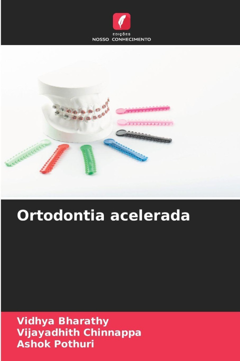 Book Ortodontia acelerada Vijayadhith Chinnappa